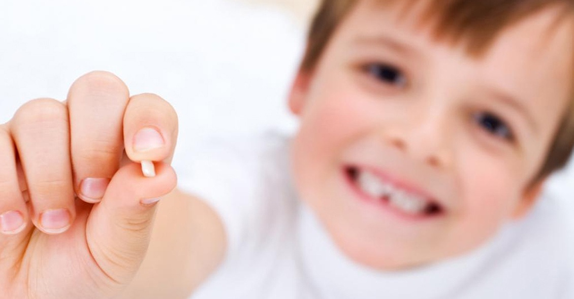 ¿La caries de un diente de leche puede afectar al diente definitivo?