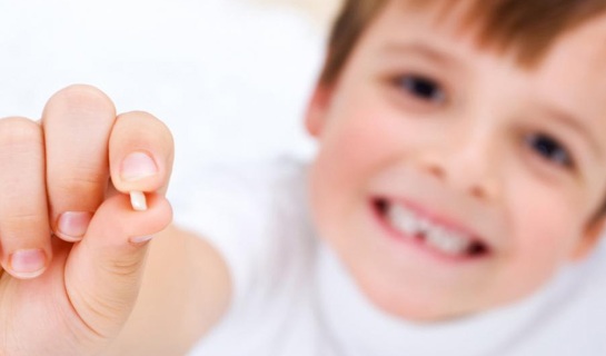 ¿La caries de un diente de leche puede afectar al diente definitivo?